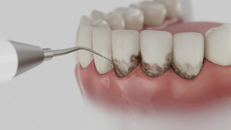 Trusted Invisalign Clear Aligners service in Rockfish, NC - Dentist Open Now
